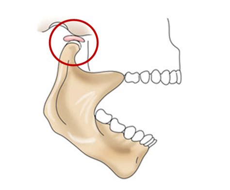 Что делать при боли в челюстях и височно-нижнечелюстном суставе
